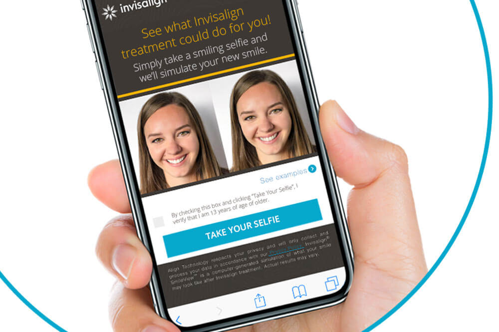 INVISALIGN SMILEVIEW™ FOR A GLIMPSE INTO THE FUTURE