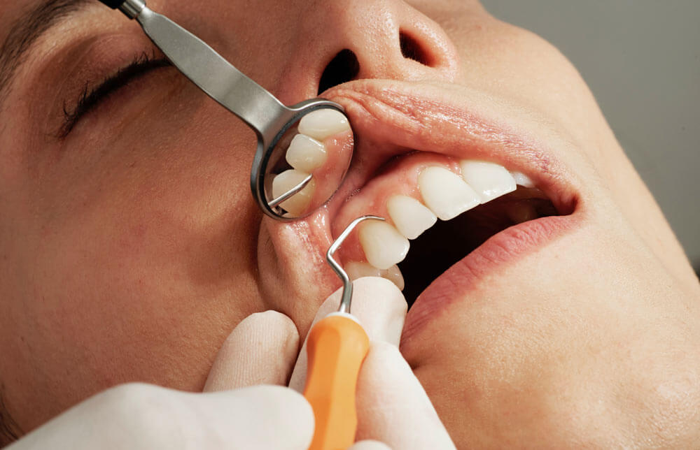 Cosmetic Dentistry The early stages of gum disease can be reversed.